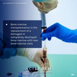 بیمارستان آجی بادم آجیبادم کارتیسل پیوند مغز استخوان 